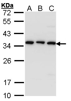 TBCB / CKAP1 Antibody - Sample (30 ug of whole cell lysate). A: A431 , B: H1299, C: Hela. 12% SDS PAGE. TBCB / CKAP1 antibody diluted at 1:1000.