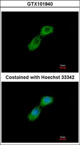 TBCB / CKAP1 Antibody - Immunofluorescence of methanol-fixed A549 using CKAP1 antibody at 1:500 dilution.