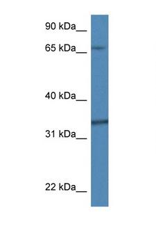 TBCB / CKAP1 Antibody - TBCB / CKAP1 antibody Western blot of Mouse Thymus lysate. Antibody concentration 1 ug/ml. This image was taken for the unconjugated form of this product. Other forms have not been tested.