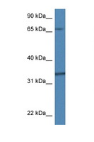 TBCB / CKAP1 Antibody - TBCB / CKAP1 antibody Western blot of Mouse Thymus lysate. Antibody concentration 1 ug/ml. This image was taken for the unconjugated form of this product. Other forms have not been tested.