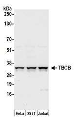 TBCB / CKAP1 Antibody - Detection of human TBCB by western blot. Samples: Whole cell lysate (50 µg) from HeLa, HEK293T, and Jurkat cells prepared using NETN lysis buffer. Antibody: Affinity purified rabbit anti-TBCB antibody used for WB at 0.4 µg/ml. Detection: Chemiluminescence with an exposure time of 10 seconds.
