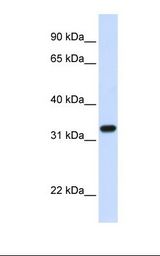TBCB / CKAP1 Antibody - Fetal lung lysate. Antibody concentration: 1.0 ug/ml. Gel concentration: 12%.  This image was taken for the unconjugated form of this product. Other forms have not been tested.