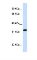 TBCB / CKAP1 Antibody - Fetal lung lysate. Antibody concentration: 1.0 ug/ml. Gel concentration: 12%.  This image was taken for the unconjugated form of this product. Other forms have not been tested.