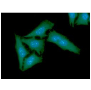TBCB / CKAP1 Antibody - ICC/IF analysis of TBCB in HeLa cells line, stained with DAPI (Blue) for nucleus staining and monoclonal anti-human TBCB antibody (1:100) with goat anti-mouse IgG-Alexa fluor 488 conjugate (Green).