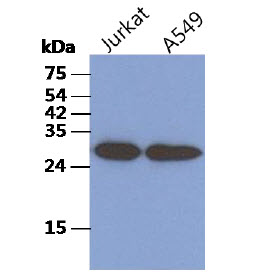 TBCB / CKAP1 Antibody - The cell lysates of Jurkat(40ug) and A549(40ug) were resolved by SDS-PAGE, transferred to PVDF membrane and probed with anti-human TBCB antibody (1:1500). Proteins were visualized using a goat anti-mouse secondary antibody conjugated to HRP and an ECL detection system.