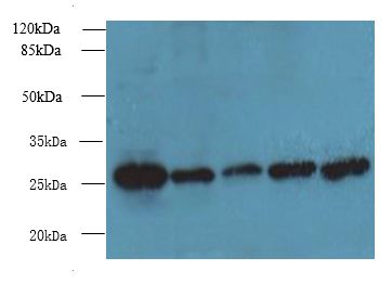 TBCB / CKAP1 Antibody - Western blot. All lanes: TBCB antibody at 4 ug/ml. Lane 1: HeLa whole cell lysate. Lane 2: A431 whole cell lysate. Lane 3: Mouse thymus tissue. Lane 4: A549 whole cell lysate. Lane 5: Jurkat whole cell lysate. Secondary Goat polyclonal to Rabbit IgG at 1:10000 dilution. Predicted band size: 27 kDa. Observed band size: 27 kDa.