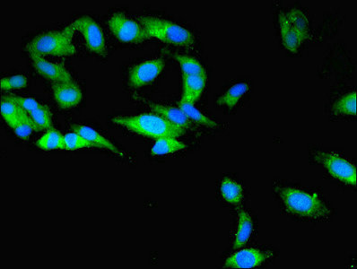 TBCB / CKAP1 Antibody - Immunofluorescent analysis of Hela cells using TBCB Antibody at dilution of 1:100 and Alexa Fluor 488-congugated AffiniPure Goat Anti-Rabbit IgG(H+L)