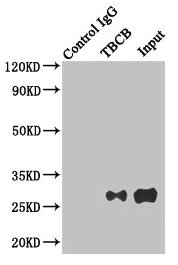 TBCB / CKAP1 Antibody - Immunoprecipitating TBCB in Hela whole cell lysate Lane 1: Rabbit monoclonal IgG (1µg) instead of TBCB Antibody in Hela whole cell lysate.For western blotting, a HRP-conjugated anti-rabbit IgG, specific to the non-reduced form of IgG was used as the Secondary antibody (1/50000) Lane 2: TBCB Antibody (4µg) + Hela whole cell lysate (500µg) Lane 3: Hela whole cell lysate (20µg)