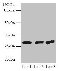 TBCB / CKAP1 Antibody - Western blot All lanes: TBCB antibody at 4µg/ml Lane 1: Hela whole cell lysate Lane 2: A431 whole cell lysate Lane 3: Mouse thymus tissue Lane 4: A549 whole cell lysate Lane 5: Jurkat whole cell lysate Secondary Goat polyclonal to rabbit IgG at 1/10000 dilution Predicted band size: 28, 22 kDa Observed band size: 28 kDa