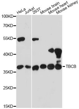 TBCB / CKAP1 Antibody - Western blot analysis of extracts of various cell lines, using TBCB antibody at 1:3000 dilution. The secondary antibody used was an HRP Goat Anti-Rabbit IgG (H+L) at 1:10000 dilution. Lysates were loaded 25ug per lane and 3% nonfat dry milk in TBST was used for blocking. An ECL Kit was used for detection and the exposure time was 30s.
