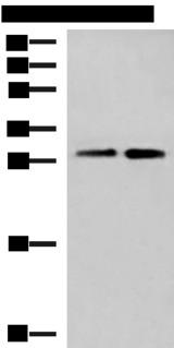 TBCB / CKAP1 Antibody - Western blot analysis of A549 cell and Human cerebrum tissue lysates  using TBCB Polyclonal Antibody at dilution of 1:500