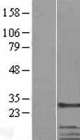 TBCB / CKAP1 Protein - Western validation with an anti-DDK antibody * L: Control HEK293 lysate R: Over-expression lysate