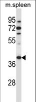 TBCC Antibody - TBCC Antibody (N-term ) western blot of mouse spleen tissue lysates (35 ug/lane). The TBCC antibody detected the TBCC protein (arrow).
