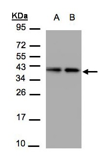 TBCC Antibody - Sample (30 ug of whole cell lysate). A: A431, B: H1299. 12% SDS PAGE. TBCC antibody diluted at 1:1500