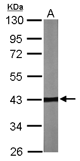 TBCC Antibody - Sample (30 ug of whole cell lysate). A: NIH-3T3. 10% SDS PAGE. TBCC antibody diluted at 1:2000.
