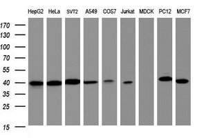 TBCC Antibody - Western blot of extracts (35ug) from 9 different cell lines by using anti-TBCC monoclonal antibody (HepG2: human; HeLa: human; SVT2: mouse; A549: human; COS7: monkey; Jurkat: human; MDCK: canine; PC12: rat; MCF7: human).