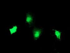 TBCC Antibody - Anti-TBCC mouse monoclonal antibody immunofluorescent staining of COS7 cells transiently transfected by pCMV6-ENTRY TBCC.