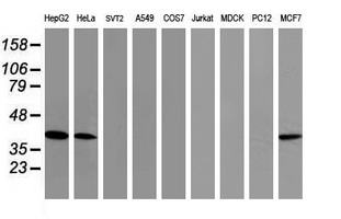 TBCC Antibody - Western blot of extracts (35ug) from 9 different cell lines by using anti-TBCC monoclonal antibody (HepG2: human; HeLa: human; SVT2: mouse; A549: human; COS7: monkey; Jurkat: human; MDCK: canine; PC12: rat; MCF7: human).