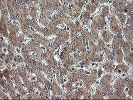 TBCC Antibody - IHC of paraffin-embedded Human liver tissue using anti-TBCC mouse monoclonal antibody.