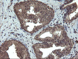 TBCC Antibody - IHC of paraffin-embedded Human prostate tissue using anti-TBCC mouse monoclonal antibody.