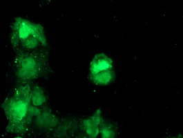 TBCC Antibody - Anti-TBCC mouse monoclonal antibody immunofluorescent staining of COS7 cells transiently transfected by pCMV6-ENTRY TBCC.