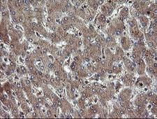 TBCC Antibody - IHC of paraffin-embedded Human liver tissue using anti-TBCC mouse monoclonal antibody.