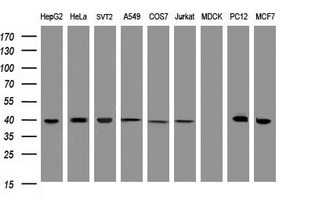 TBCC Antibody - Western blot of extracts (35 ug) from 9 different cell lines by using g anti-TBCC monoclonal antibody (HepG2: human; HeLa: human; SVT2: mouse; A549: human; COS7: monkey; Jurkat: human; MDCK: canine; PC12: rat; MCF7: human).