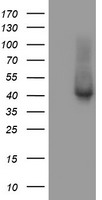 TBCC Antibody - HEK293T cells were transfected with the pCMV6-ENTRY control (Left lane) or pCMV6-ENTRY TBCC (Right lane) cDNA for 48 hrs and lysed. Equivalent amounts of cell lysates (5 ug per lane) were separated by SDS-PAGE and immunoblotted with anti-TBCC.