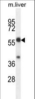 TBCCD1 Antibody - TBCCD1 Antibody western blot of mouse liver tissue lysates (35 ug/lane). The TBCCD1 antibody detected the TBCCD1 protein (arrow).
