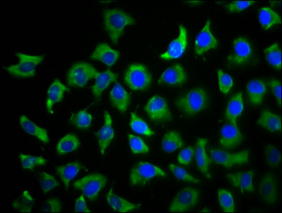 TBCD Antibody - Immunofluorescence staining of A549 cells diluted at 1:100, counter-stained with DAPI. The cells were fixed in 4% formaldehyde, permeabilized using 0.2% Triton X-100 and blocked in 10% normal Goat Serum. The cells were then incubated with the antibody overnight at 4°C.The Secondary antibody was Alexa Fluor 488-congugated AffiniPure Goat Anti-Rabbit IgG (H+L).