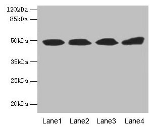 TBCEL / E-Like Antibody - Western blot All lanes: TBCEL antibody at 12µg/ml Lane 1: Rat gonadal tissue Lane 2: PC-3 whole cell lysate Lane 3: Rat heart tissue Lane 4: 293T whole cell lysate Secondary Goat polyclonal to rabbit IgG at 1/10000 dilution Predicted band size: 48 kDa Observed band size: 48 kDa
