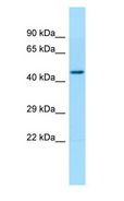 TBCEL / E-Like Antibody - TBCEL / E-Like antibody Western Blot of Fetal Heart.  This image was taken for the unconjugated form of this product. Other forms have not been tested.