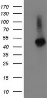TBCEL / E-Like Antibody - HEK293T cells were transfected with the pCMV6-ENTRY control (Left lane) or pCMV6-ENTRY TBCEL (Right lane) cDNA for 48 hrs and lysed. Equivalent amounts of cell lysates (5 ug per lane) were separated by SDS-PAGE and immunoblotted with anti-TBCEL.