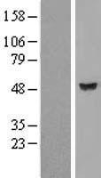TBCEL / E-Like Protein - Western validation with an anti-DDK antibody * L: Control HEK293 lysate R: Over-expression lysate