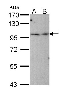 TBCK / TBCKL Antibody - Sample (30 ug of whole cell lysate). A: Hep G2 , B: Molt-4 . 7.5% SDS PAGE. TBCK antibody diluted at 1:1000.