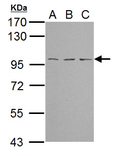 TBCK / TBCKL Antibody - Sample (30 ug of whole cell lysate). A: NIH-3T3, B: JC, C: BCL-1. 7.5% SDS PAGE. TBCK antibody diluted at 1:1000.