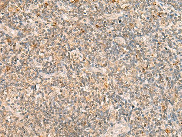 TBCK / TBCKL Antibody - Immunohistochemistry of paraffin-embedded Human tonsil tissue  using TBCK Polyclonal Antibody at dilution of 1:25(×200)