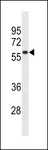 TBKBP1 Antibody - MOUSE Tbkbp1 Antibody western blot of mouse bladder tissue lysates (35 ug/lane). The MOUSE Tbkbp1 antibody detected the MOUSE Tbkbp1 protein (arrow).