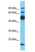 TBKBP1 Antibody - TBKBP1 antibody Western Blot of Jurkat. Antibody dilution: 1 ug/ml.  This image was taken for the unconjugated form of this product. Other forms have not been tested.