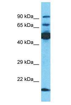 TBKBP1 Antibody - TBKBP1 antibody Western Blot of Jurkat. Antibody dilution: 1 ug/ml.  This image was taken for the unconjugated form of this product. Other forms have not been tested.