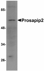 TBKBP1 Antibody - Western blot of Prosapip2 in rat liver tissue lysate with Prosapip2 antibody at 1 ug/ml. Below: Immunohistochemistry of Prosapip2 in rat liver tissue with Prosapip2 antibody at 5 ug/ml.