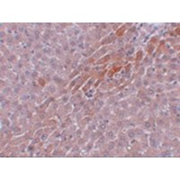 TBKBP1 Antibody - Immunohistochemistry of Prosapip2 in rat liver tissue with Prosapip2 antibody at 5 µg/mL.