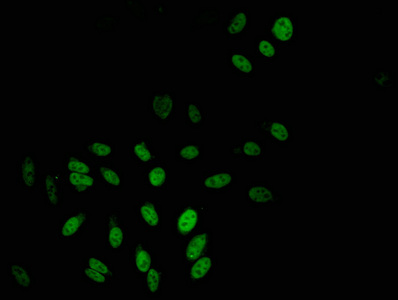 TBL1X / TBL1 Antibody - Immunofluorescent analysis of Hela Cells Cells at a dilution of 1:100 and Alexa Fluor 488-congugated AffiniPure Goat Anti-Rabbit IgG(H+L)