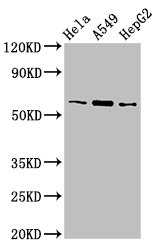 TBL1X / TBL1 Antibody - Positive Western Blot detected in Hela whole cell lysate, A549 whole cell lysate, HepG2 whole cell lysate. All lanes: TBL1X antibody at 3 µg/ml Secondary Goat polyclonal to rabbit IgG at 1/50000 dilution. Predicted band size: 63 KDa. Observed band size: 63 KDa