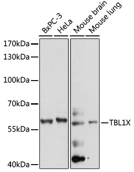 TBL1X / TBL1 Antibody - Western blot analysis of extracts of various cell lines, using TBL1X antibody at 1:1000 dilution. The secondary antibody used was an HRP Goat Anti-Rabbit IgG (H+L) at 1:10000 dilution. Lysates were loaded 25ug per lane and 3% nonfat dry milk in TBST was used for blocking. An ECL Kit was used for detection and the exposure time was 60s.