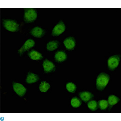 TBL1X / TBL1 Antibody - Immunocytochemistry staining of HeLa cells fixed with 4% Paraformaldehyde and using anti-TBL1X mouse mAb (dilution 1:100).