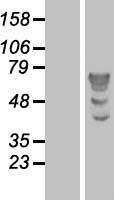 TBL1X / TBL1 Protein - Western validation with an anti-DDK antibody * L: Control HEK293 lysate R: Over-expression lysate
