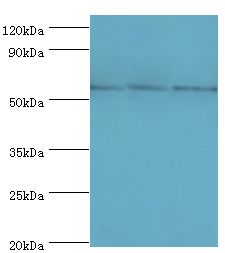 TBL1XR1 / TBLR1 Antibody - Western blot. All lanes: F-box-like/WD repeat-containing protein TBL1XR1 antibody at 10 ug/ml. Lane 1: MCF-7 whole cell lysate. Lane 2: mouse heart tissue. Lane 3: K562 whole cell lysate. secondary Goat polyclonal to rabbit at 1:10000 dilution. Predicted band size: 56 kDa. Observed band size: 56 kDa.