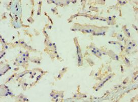 TBL1XR1 / TBLR1 Antibody - Immunohistochemistry of paraffin-embedded human prostate tissue using antibody at 1:100 dilution.