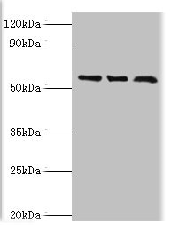 TBL1XR1 / TBLR1 Antibody - Western blot All lanes: F-box-like/WD repeat-containing protein TBL1XR1 antibody at 10µg/ml Lane 1: MCF-7 whole cell lysate Lane 2: Mouse heart tissue Lane 3: K562 whole cell lysate Secondary Goat polyclonal to rabbit IgG at 1/10000 dilution Predicted band size: 56 kDa Observed band size: 56 kDa